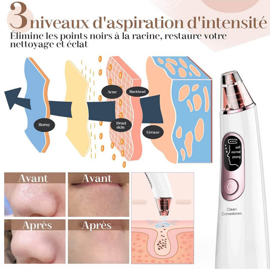 Mitesserstaubsauger, Porenreiniger, LED-Display, 4 Sonden, 3 Schönheitsmodi für das Gesicht.